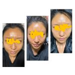 Keunggulan Produk L.ma LED Masker