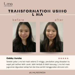Dengan L.ma Wajah Terasa Lebih Halus dan Lebih Glowing