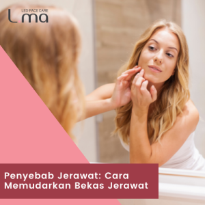 Penyebab Jerawat: Cara Memudarkan & Menyembunyikan Bekas Jerawat