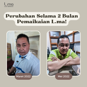 Perubahan Selama 2 Bulan Pemaikaian L.ma!